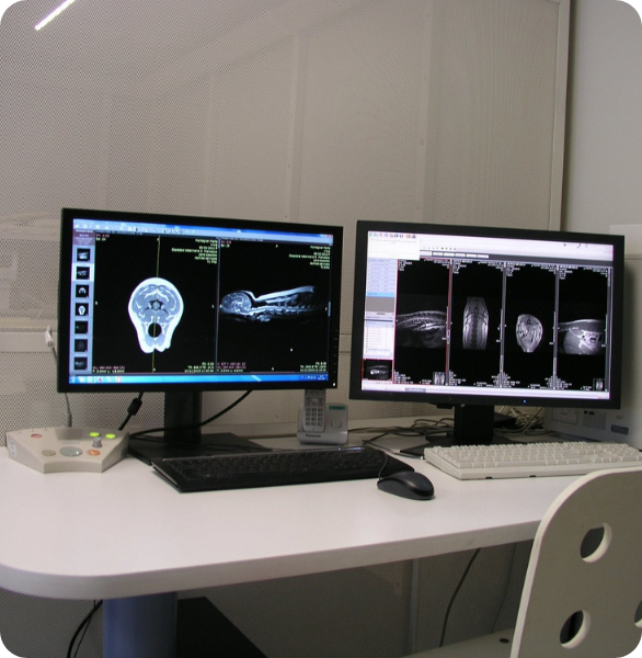 Risultati di MRI sullo schermo per lo studio di encefalo e midollo spinale